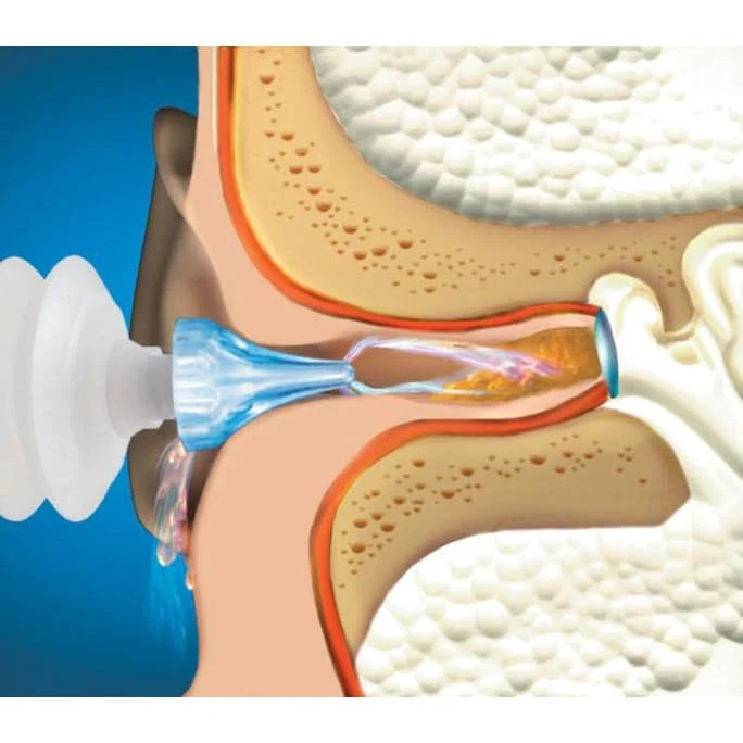 Macks ProRinse Earwax Removal Syringe - Image 4
